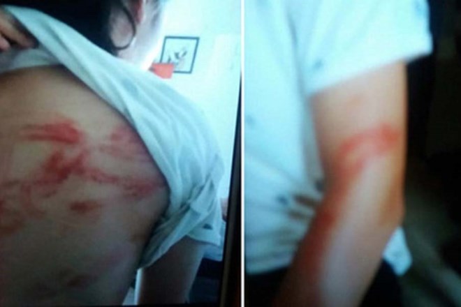 Hai cháu bé ở Hà Nội bị bố bạo hành đang ở nhà bác ruột ảnh 1